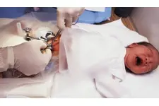 Bebek Pipisinde Kızarıklık Belirtileri ve Tedavisi Bebek Pipisinde Kızarıklık Belirtileri ve Tedavisi