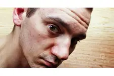 Yüzde Kızarıklık Belirtileri ve Tedavisi Yüzde Kızarıklık Belirtileri ve Tedavisi