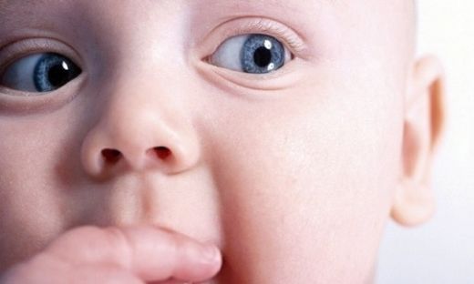 Bebeklerde Göz Altı Kızarıklığı Belirtileri ve Tedavisi