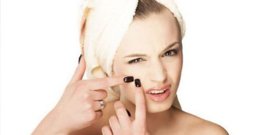 Sivilce Kızarıklığı Nasıl Geçer?